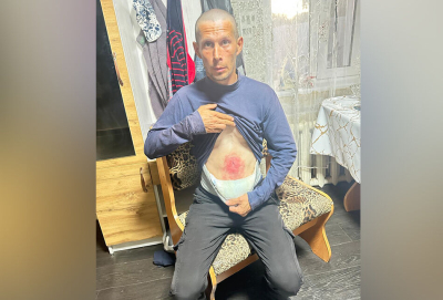 В тюрьму на лечение